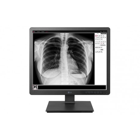 LG 19HK312C-B Clinical 5:4 IPS Monitor de Ecrã 48,3 cm (19") 1280 x 1024 pixels SXGA Preto - 8806098207114